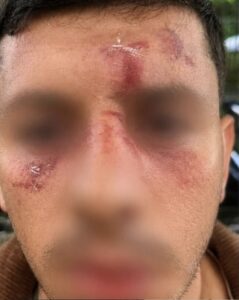 Jewish man is attacked by gang of masked men ‘after speaking Hebrew on his mobile phone’ outside home in Golders Green