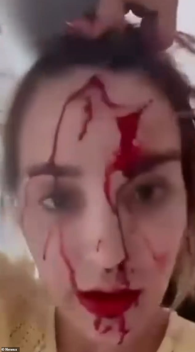 Miss Venezuela Global releases shocking footage of her covered in blood in trashed hotel room ‘after being attacked by celebrity stylist’