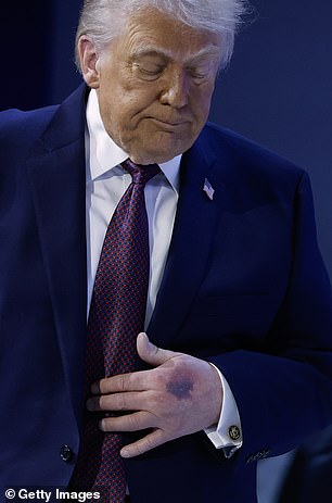 White House releases results of Donald Trump’s physical amid mounting pressure