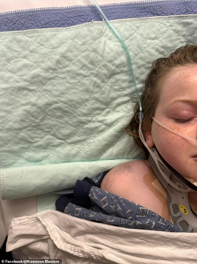 Girl, 10, left needing spinal surgery after tree fell on top of her in front of horrified siblings during family hike