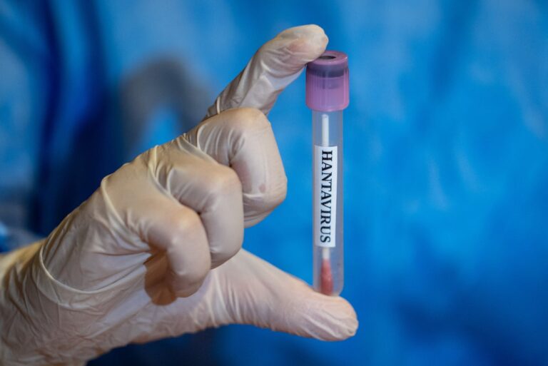 There is no vaccine for deadly hantavirus, but this scientist is working on one