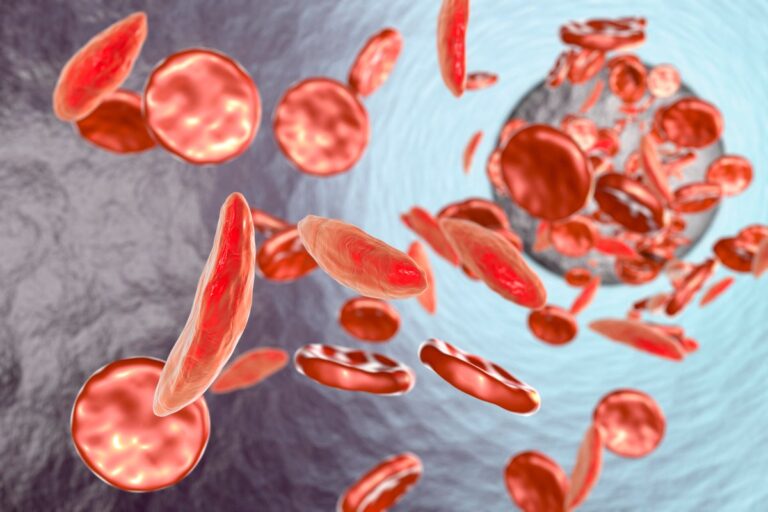 How scientists made the discoveries behind a game-changing gene therapy for sickle cell disease and won a $3-million Breakthrough Prize