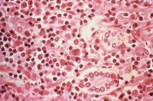 Why hantavirus takes so long to show symptoms and what that means for containment