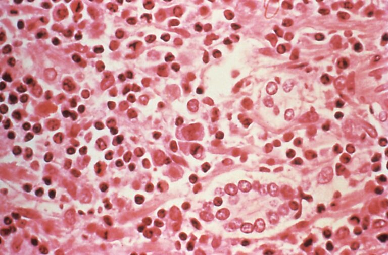 Why hantavirus takes so long to show symptoms and what that means for containment