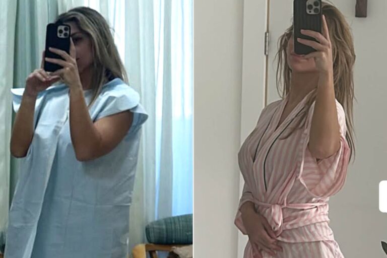 After a ‘Tear During Birth,’ Fitness Influencer Sought a Labiaplasty for Repair and Documented It on Social Media