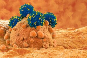 CAR T-cell therapy bolstered by stiffening up cancer cells first