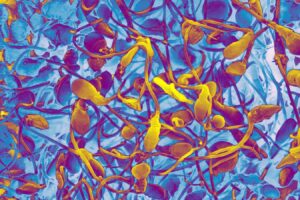 Will lab-grown sperm let infertile men have children of their own?