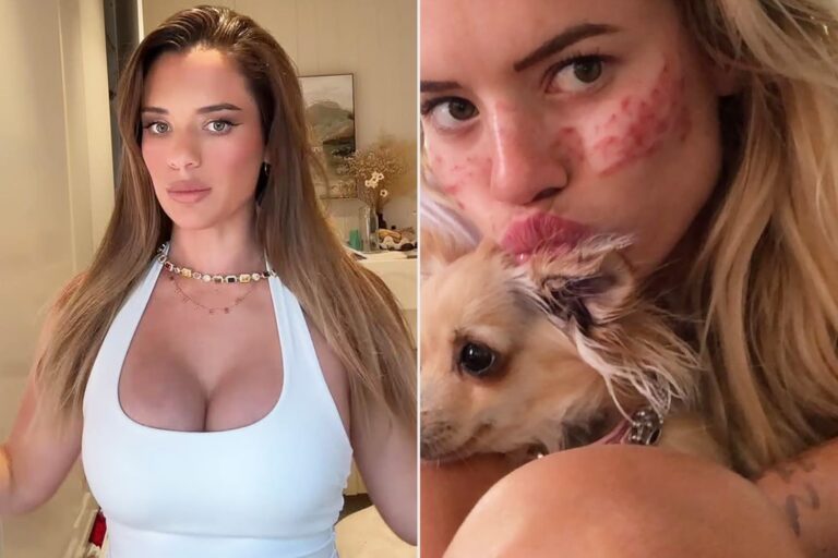 After Cheek Filler, Veneers and a Boob Job That Made Her Sick, This Mom, 26, Is Now ‘Reversing the Damage’ (Exclusive)