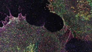 Hidden sugar patterns on human cells could reveal cancer early