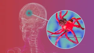 Researchers block key protein that helps Parkinson’s spread through the brain