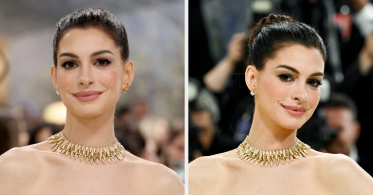 Anne Hathaway Addressed Rumors That She's Gotten A Facelift