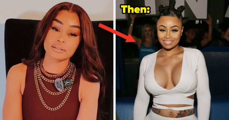 Blac Chyna Just Revealed Every Cosmetic Procedure She's Had — And The Ones She Hasn't
