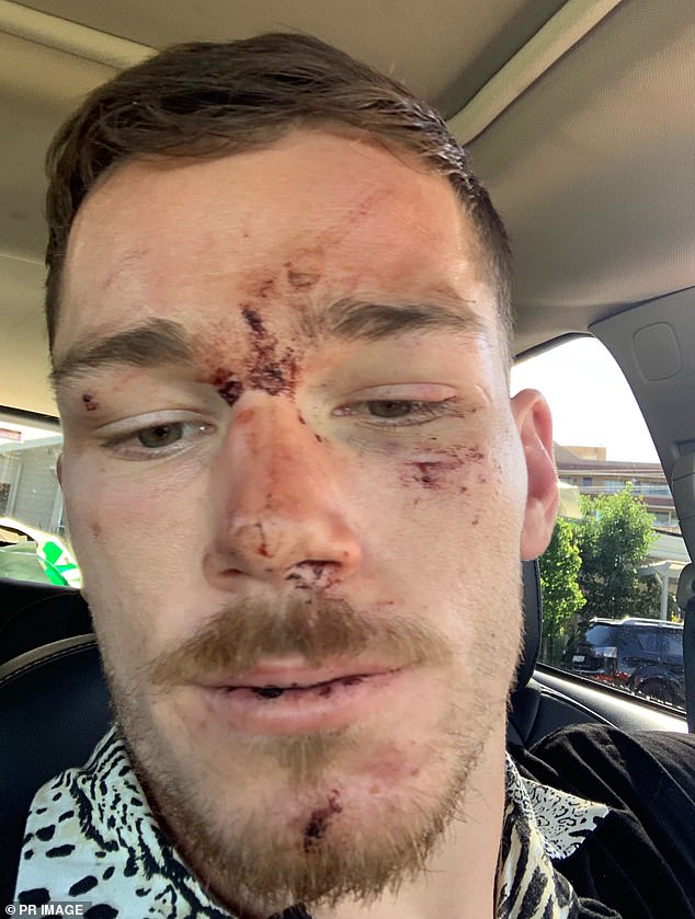 Cop reveals why he blew the whistle on his fellow officers after they allegedly bashed NRL star Tom Starling unconscious