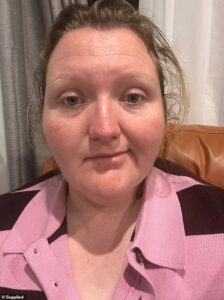 Exhausted mum who woke up with half her face paralysed blames the stress of the NDIS for her condition