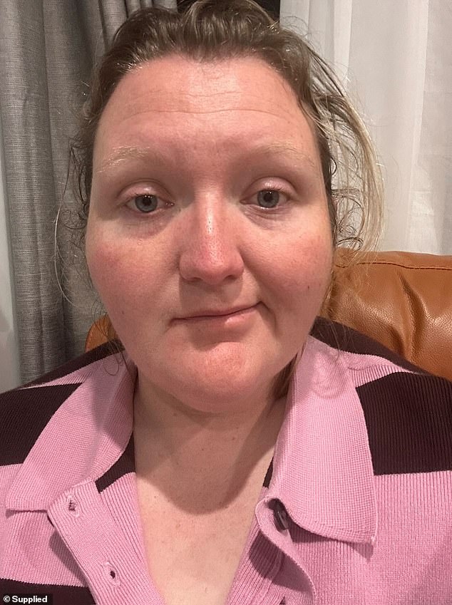 Exhausted mum who woke up with half her face paralysed blames the stress of the NDIS for her condition
