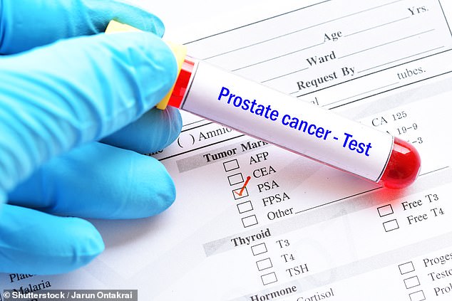 New prostate cancer test detects more dangerous tumours than standard PSA screening, study finds