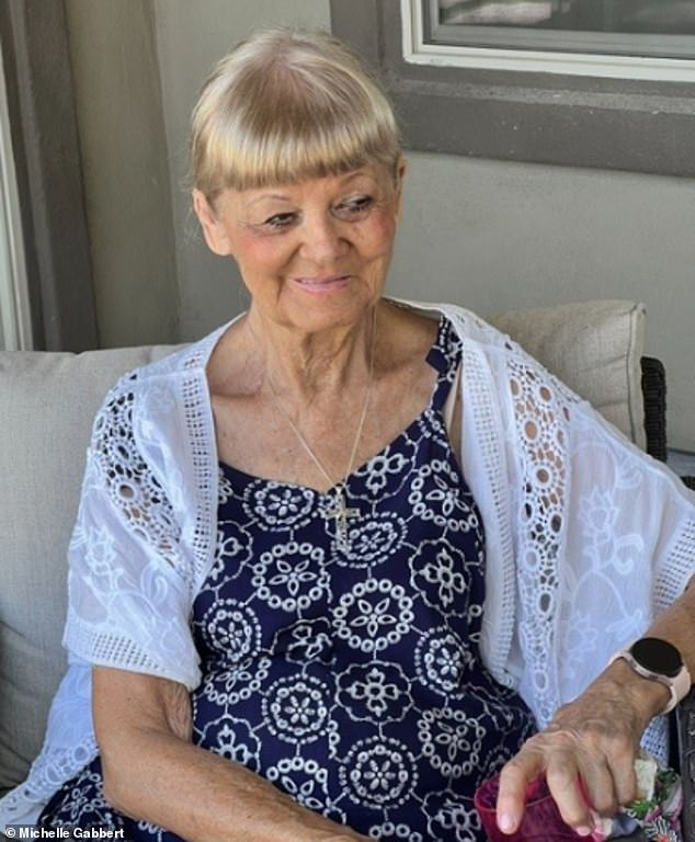 Arizona woman, 82, suffers horrific burns after falling asleep while tanning on metal chair by side of swimming pool