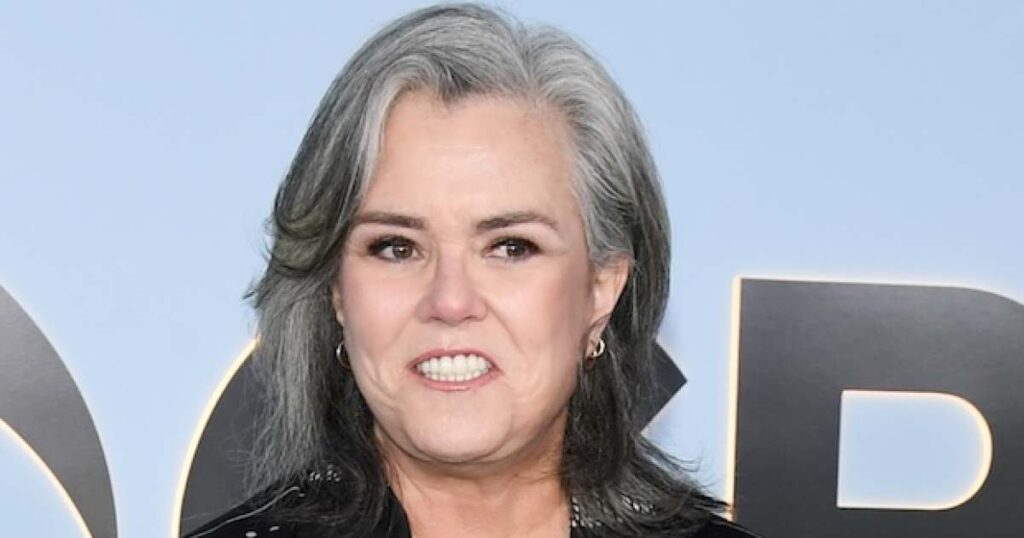 Rosie O’Donnell Addresses More Plastic Surgery After Facelift
