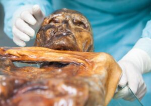Ötzi the murdered Iceman’s microbiome is still active