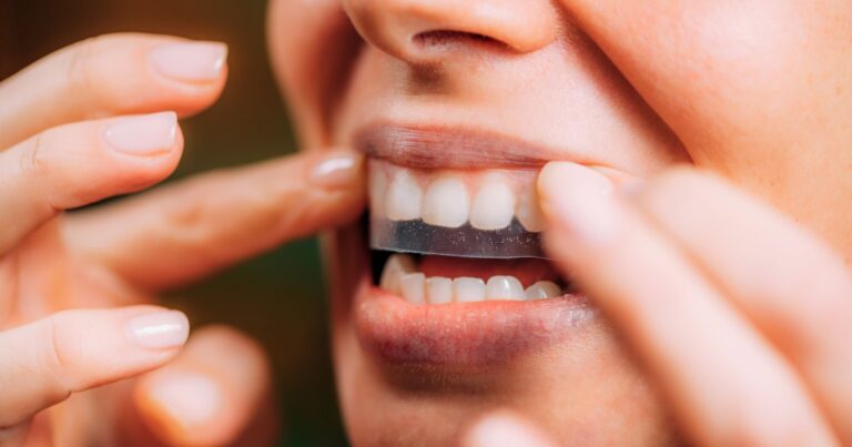 These Whitening Strips Brighten Teeth Without the Sensitivity