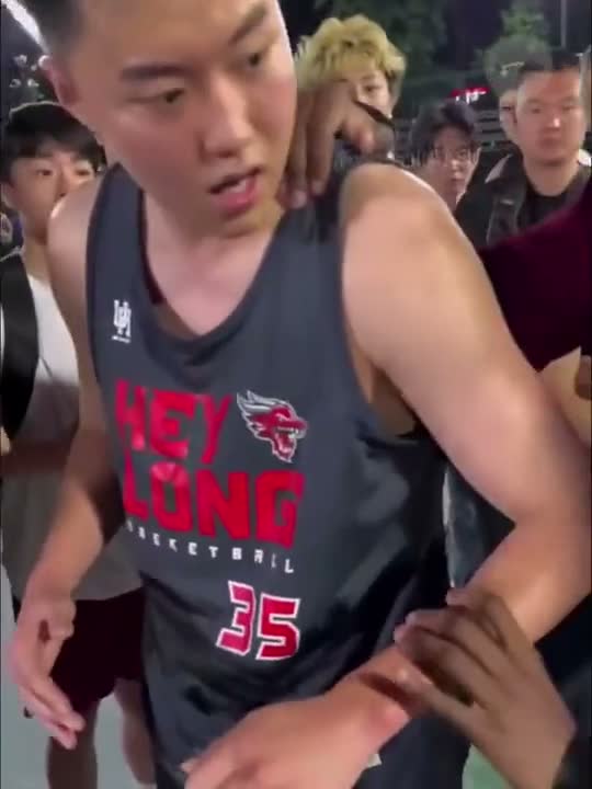 Dislocated Shoulder