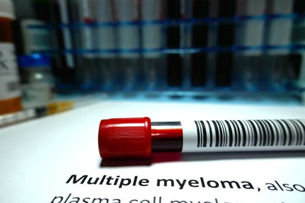 J&J multiple myeloma drug Talvey cuts mortality risk (JNJ:NYSE)