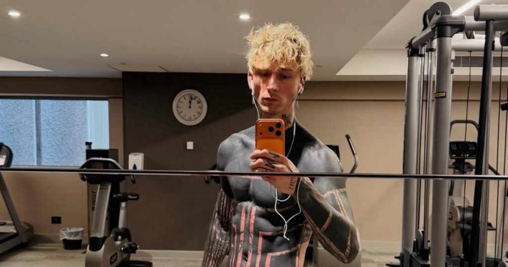 MGK’s Skin Turned ‘Yellow’ After Rushing Blackout Tattoo