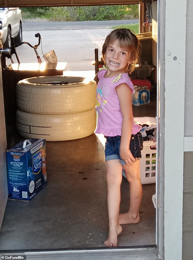 California girl, 7, is SCALPED by pack of six vicious stray dogs while playing outside