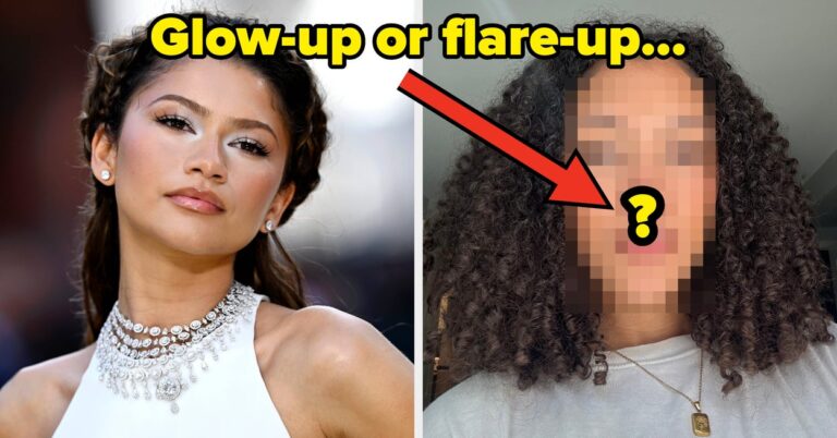 Zendaya’s Charlotte Tilbury Cream: Sensitive Skin Review
