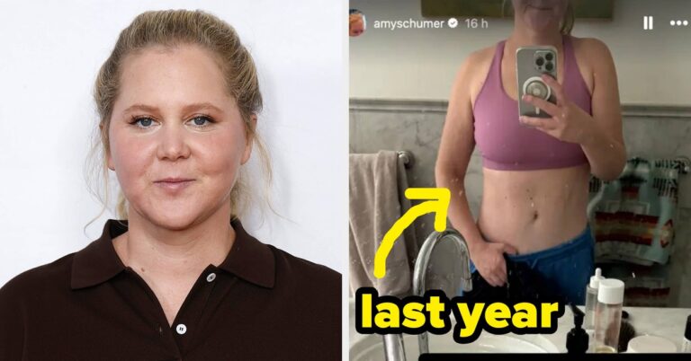 After More Than A Year On Mounjaro, Amy Schumer Showed What Her Body Looks Like With New Unfiltered Bikini Pics